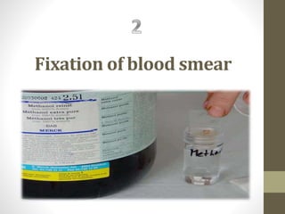 Fixation of blood smear
 