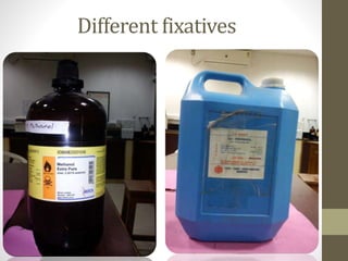 Different fixatives
 