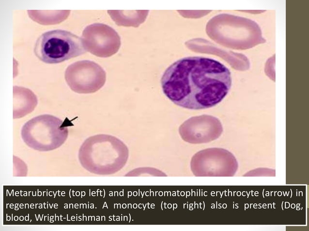 Blood smear staining | PPTX | Blood Disorders | Diseases and Conditions