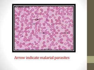 Arrow indicatemalarial parasites
 