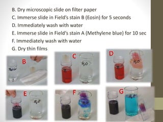 B. Dry microscopic slide on filter paper
C. Immerse slide in Field’s stain B (Eosin) for 5 seconds
D. Immediately wash with water
E. Immerse slide in Field‘s stain A (Methylene blue) for 10 sec
F. Immediately wash with water
G. Dry thin films
 
