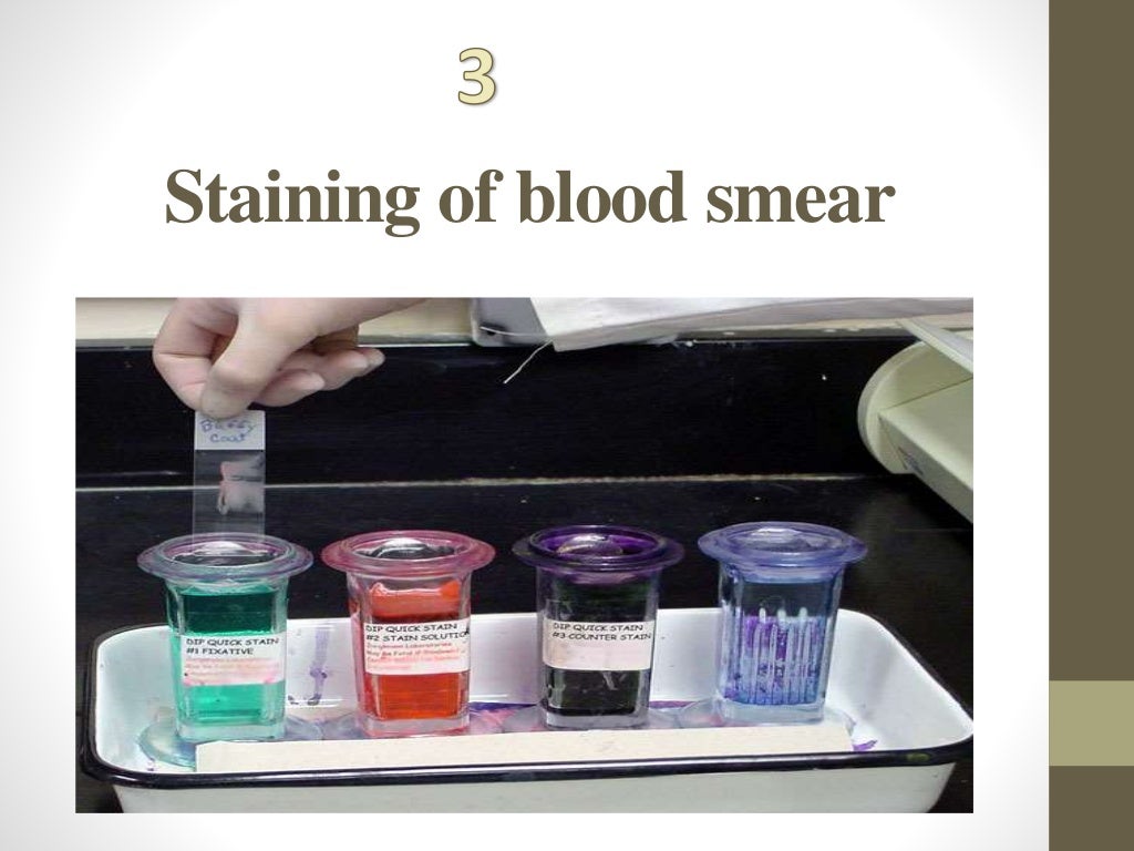 Blood smear staining