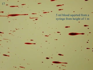 Point of Convergence 5 ml blood squirted from a  syringe from height of 1 m 17 