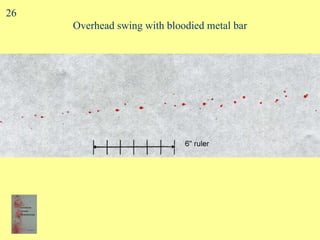 Overhead swing with bloodied metal bar 26 