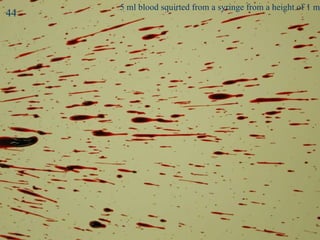 Splash 3 5 ml blood squirted from a syringe from a height of 1 m 44 