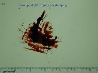 Stamp 2 Blood pool (10 drops) after stamping 49 
