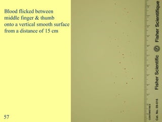 Flick 2: Blood flicked between  middle finger & thumb  onto a vertical smooth surface  from a distance of 15 cm 57 