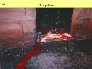 Flow pattern 72 