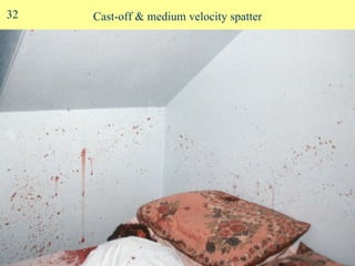 Cast-off & medium velocity spatter 32 