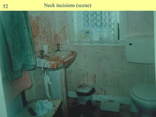 Neck incisions (scene) 52 