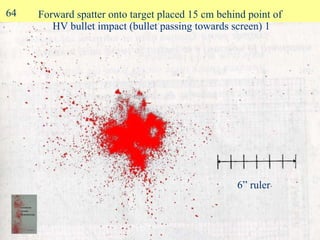 Forward spatter onto target placed 15 cm behind point of  HV bullet impact (bullet passing towards screen) 1 6” ruler 64 