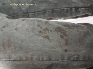Bloodspots on trousers 78 