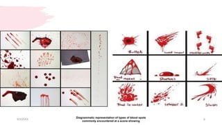 9/3/20XX
Diagrammatic representation of types of blood spots
commonly encountered at a scene showing
9
 
