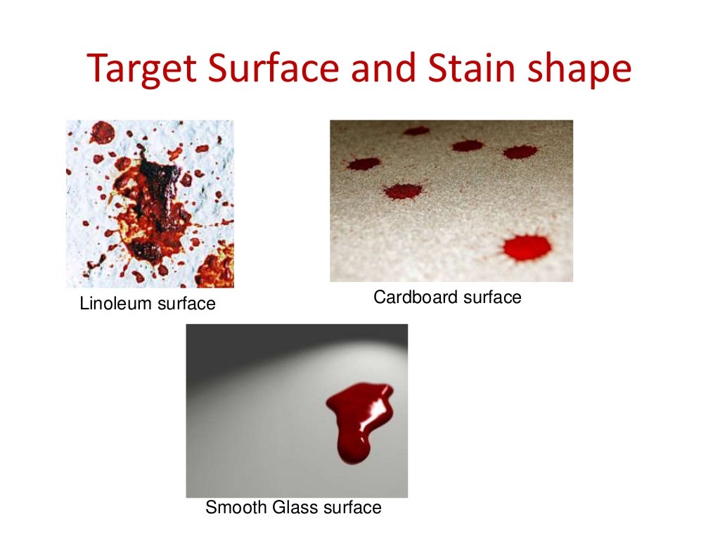 Blood stain pattern analysis