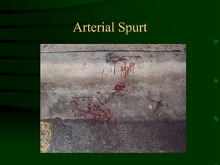 Arterial Spurt