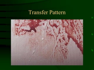 Transfer Pattern