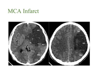 Blood supply of brain | PPT