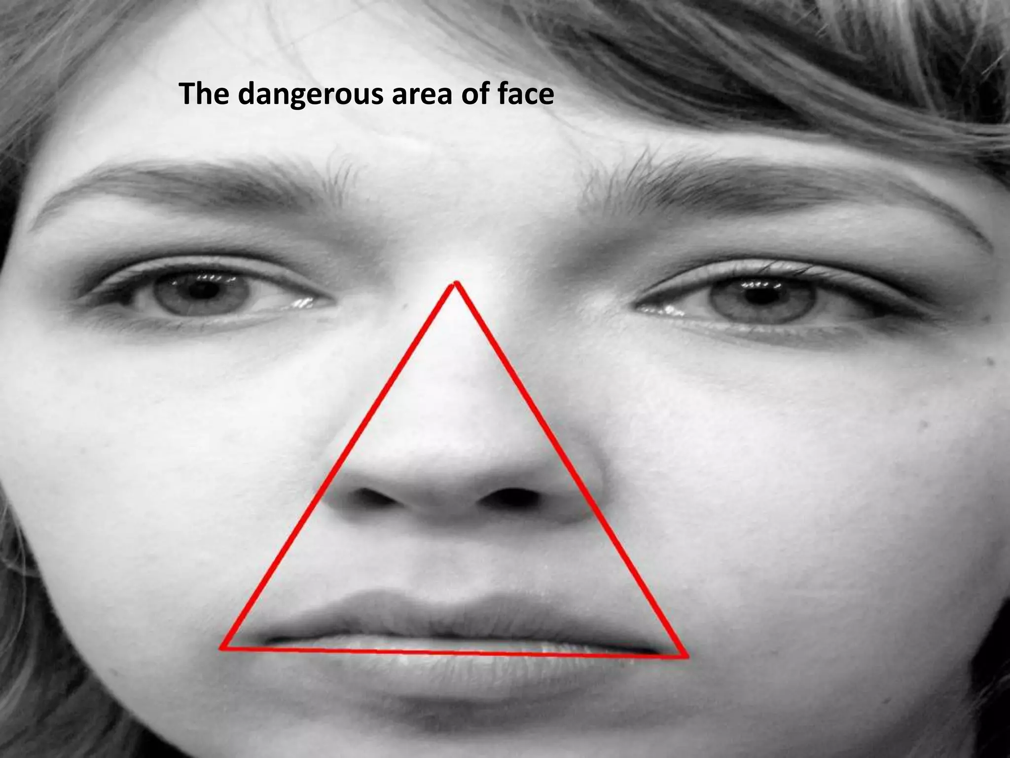 The dangerous area of face

1/7/2014

33

 