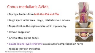 Blood supply of spinal cord | PPTX