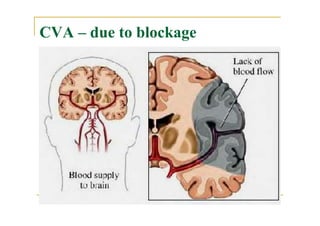 Blood supply of the brain