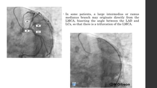 Large Ramus Branch Comprehensive Overview of the Heart's Blood Supply and Venous Drainage ...