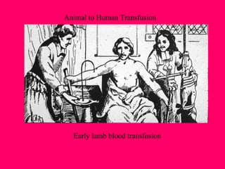 Animal to Human Transfusion Early lamb blood transfusion 