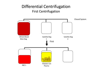Differential Centrifugation
              First Centrifugation

                                                        Closed System




Whole Blood          Satellite Bag      Satellite Bag
Main Bag                  1                  2
                                First




                     Platelet-rich
   RBC’s               Plasma
 