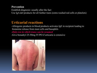 Prevention
Establish diagnosis: usually after the fact
Use IgA def products for all further tranx (extra washed red cells or platelets)
Urticarial reactions
-Allergenic products in blood products activates IgE in recipient leading to
histamine release from mast cells and basophils
-Only rxn in which tranx can be resumed
-Give benadryl 25-50mg IV/PO if urticaria is extensive
 
