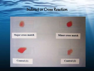Indirect or Cross Reaction
 