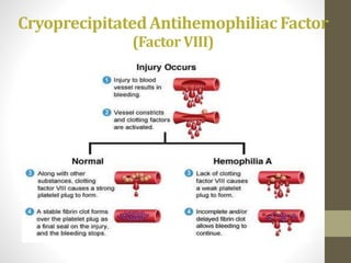 CryoprecipitatedAntihemophiliac Factor
(FactorVIII)
 