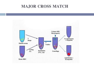 MAJOR CROSS MATCH
 