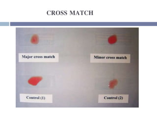 CROSS MATCH
 