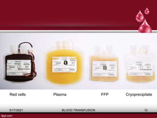 5/17/2021 BLOOD TRANSFUSION 12
Red cells Plasma FFP Cryoprecipitate
 