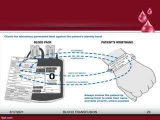 5/17/2021 BLOOD TRANSFUSION 29
 