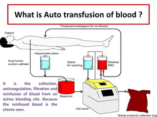 Blood transfusion | PPTX