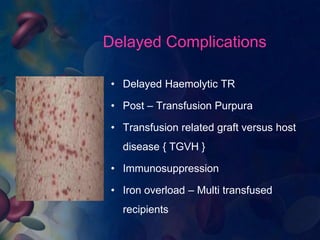Delayed Haemolytic Transfusion Reaction
• Previously sensitized to an antigen
through transfusion or pregnancy.
• Can resu...