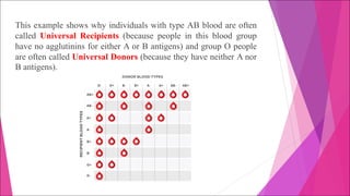 This example shows why individuals with type AB blood are often
called Universal Recipients (because people in this blood group
have no agglutinins for either A or B antigens) and group O people
are often called Universal Donors (because they have neither A nor
B antigens).
 