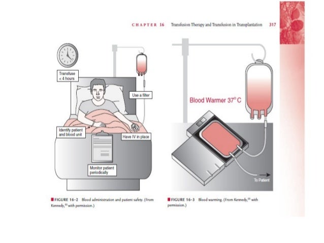 Blood transfusion guidelines in clinical practice