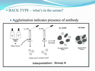  BACK TYPE – what’s in the serum?
 Agglutination indicates presence of antibody
 