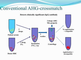 Conventional AHG-crossmatch
Patient serum
2
drops
Incubation
37oC, 1 hr
Donor RBC
1 drop,
5%
3
washes
Centrifuge
2 drops AHG
Mix properly
Agglutination =
incompatible
No agglutination
= compatible
Detects clinically significant (IgG) antibody
 