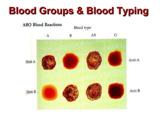 Blood Groups & Blood TypingBlood Groups & Blood Typing
 