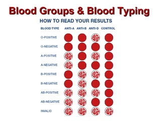 Blood Groups & Blood TypingBlood Groups & Blood Typing
 