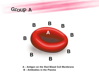 B
B
B
B
B
B
B
B
A
A - Antigen on the Red Blood Cell Membrane
B - Antibodies in the Plasma
 