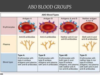 ABO BLOOD GROUPS
 