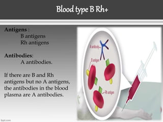 Blood type B Rh+
Antigens :
B antigens
Rh antigens
Antibodies:
A antibodies.
If there are B and Rh
antigens but no A antigens,
the antibodies in the blood
plasma are A antibodies.
 