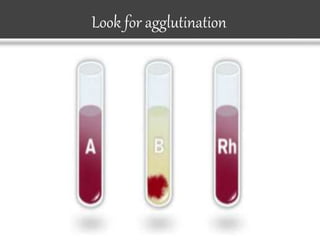 Look for agglutination
 