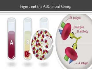 Figure out the ABO blood Group
 