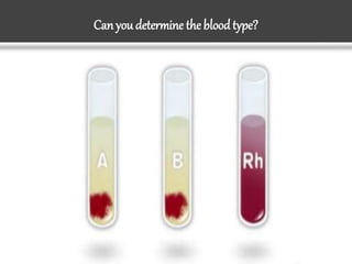 Can youdetermine the blood type?
 