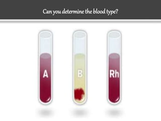 Can youdetermine the blood type?
 