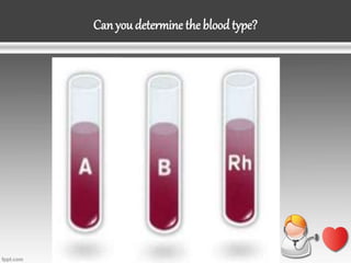 Can youdetermine the blood type?
 